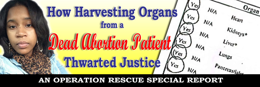 How Harvesting Organs from a Dying Abortion Patient Thwarted Justice
