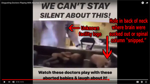 Controversial Video Shows Medical Staff Laughing While Playing with Aborted Babies