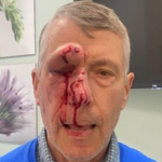 Growing Violent Attacks on Pro-Lifers 